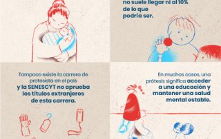 El difícil acceso a las prótesis en el Ecuador