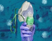 respiradores artificiales