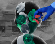 Al menos once niños fueron operados para, supuestamente, poder escuchar. Casi tres años después, la operación no muestra los resultados esperados. Ilustración de Gabriela Valarezo para GK.