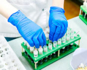 variante del covid-19 de Brasil