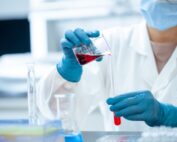 Análisis de laboratorio