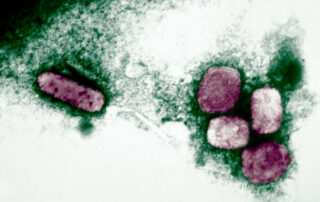 qué es la viruela del mono