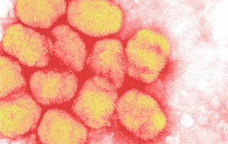 viruela del mono explicada