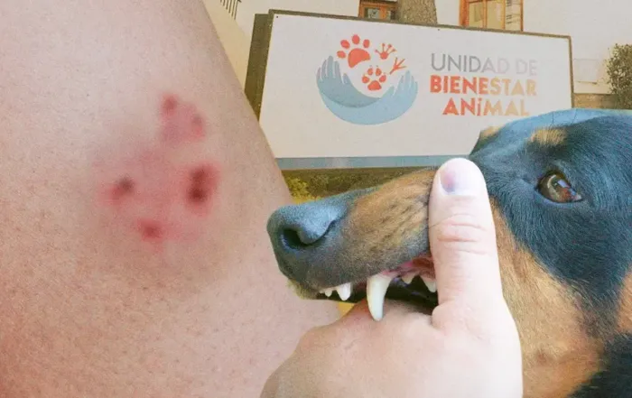Si un perro te muerde, debes lavar la herida e ir a un centro médico. Después puedes presentar una denuncia.