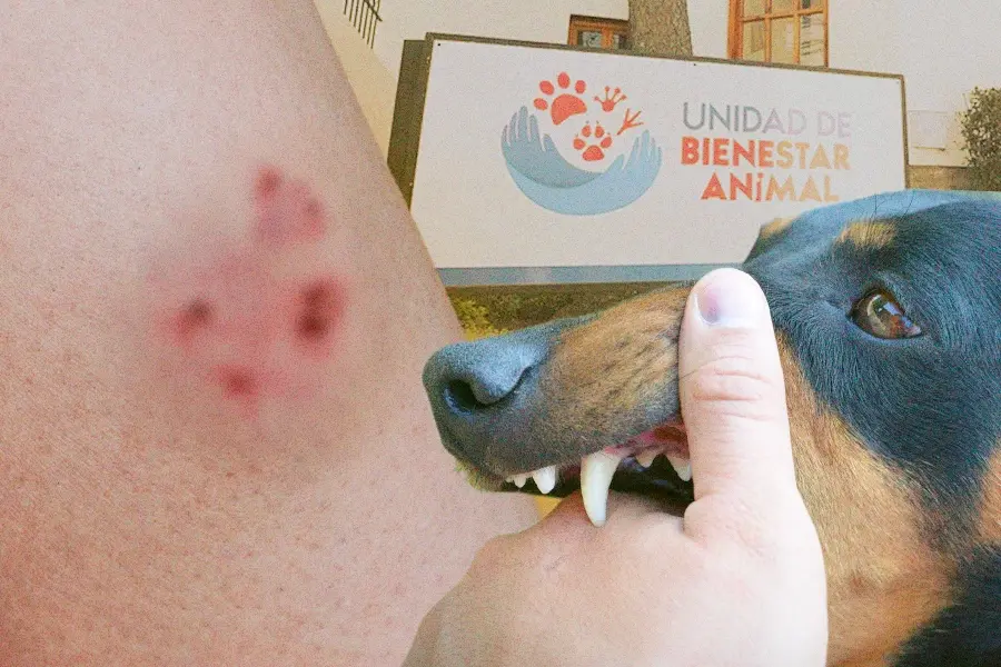 Si un perro te muerde, debes lavar la herida e ir a un centro médico. Después puedes presentar una denuncia.