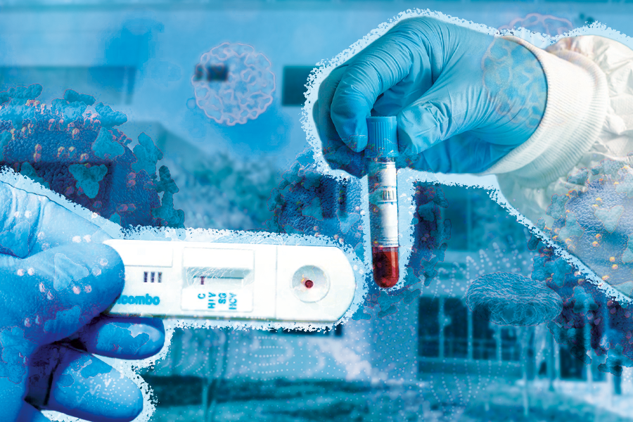 Los síntomas dependen y varían según el tipo de Infección de Transmisión Sexual (ITS).